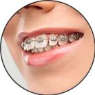 Click here to see the products of category Toothpicks