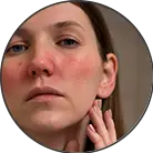 Click here to see the products of category Irritated Skin