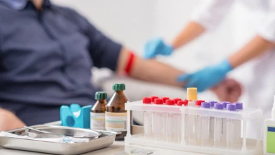 CRP: Τι Είναι, Φυσιολογικές Τιμές και Πότε να Ανησυχείτε