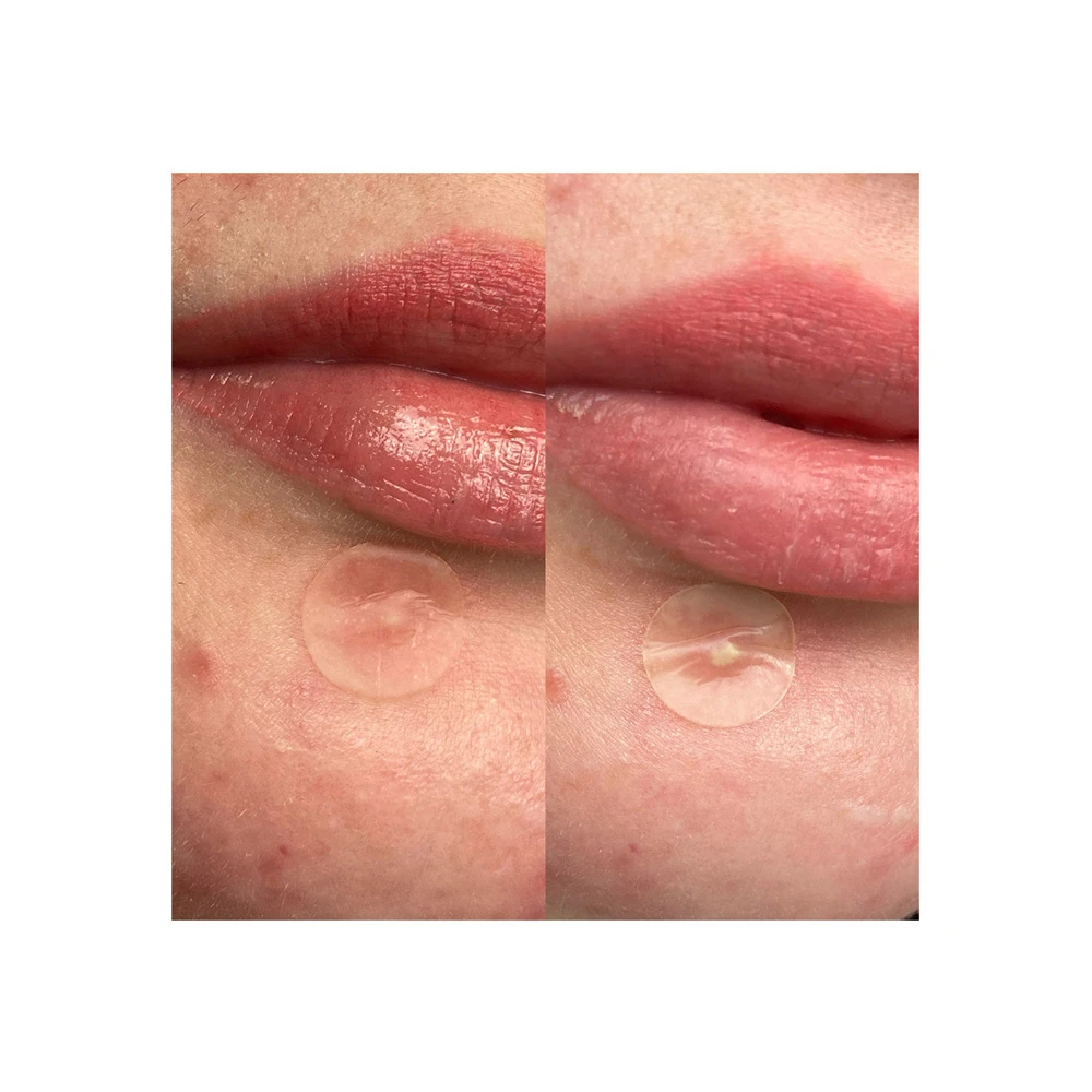 Hero. Mighty Patch Invisible+ Anti-Pimple Επιθέματα Για Σπυράκια 24 ...
